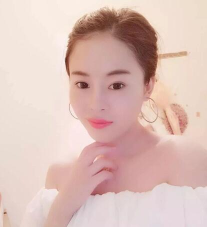 昆明大華整形美容醫(yī)院雙眼皮案例