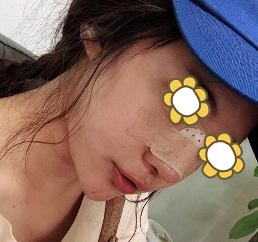 黃志祥醫(yī)生的手術(shù)案例