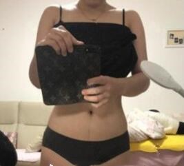 劉培醫(yī)生的術(shù)后評價