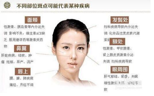 中醫(yī)去黃褐斑