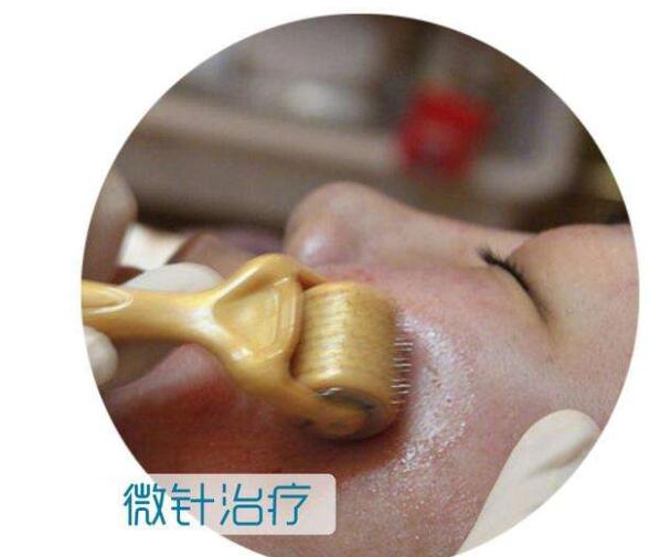 微針毀容后還能修復嗎？美容不當致毀容你需要知道真相！