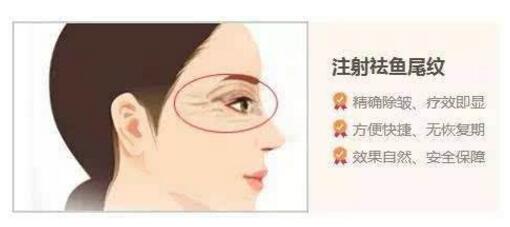 天生魚尾紋做什么手術(shù)去除好？