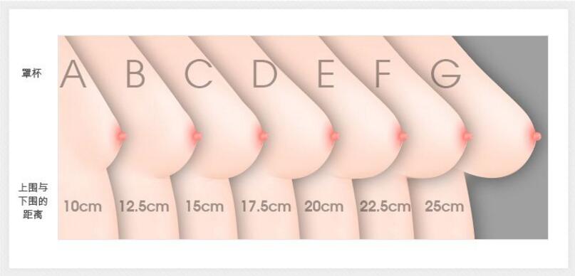 胸部整形失敗修復(fù)