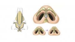 怎么讓鼻頭縮小