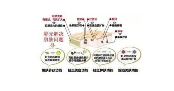 彩光嫩膚要多少錢