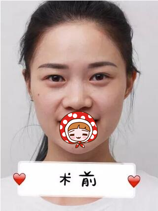 醫(yī)生的手術(shù)案例