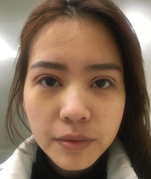 劉永生醫(yī)生的手術(shù)案例