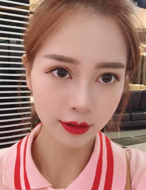 劉永生醫(yī)生的手術(shù)案例