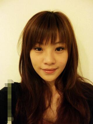 黨寧醫(yī)生的術(shù)后評價(jià)