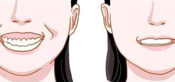 注射瘦臉除了能瘦臉腿肩