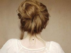 珠海一韓整形點(diǎn)痣多少錢一顆 激光點(diǎn)痣留疤嗎