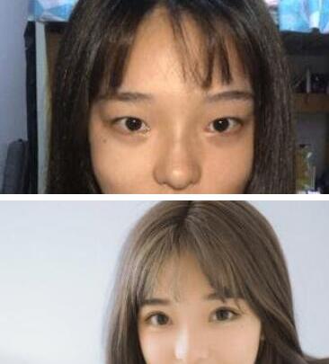 一周醫(yī)美早班資訊【2020.04.07】