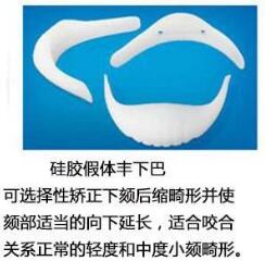 整形墊下巴做的好