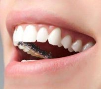 成都新橋牙科醫(yī)院怎么樣 地包天矯正果如何