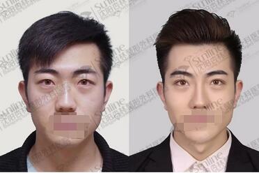 新一周醫(yī)美資訊熱點(diǎn)大集合【2020.4.13】