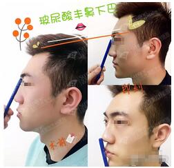 新一周醫(yī)美資訊熱點(diǎn)大集合【2020.4.13】