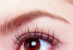 包頭劉恕整形醫(yī)院提眉的優(yōu)點有哪些  讓你眉開眼笑