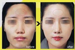 新一周醫(yī)美整形熱點(diǎn)資訊大匯集【2020.4.20】