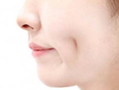 福州弘宇整形醫(yī)院人造酒窩有哪些特點(diǎn) 讓你成為萬(wàn)人迷