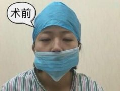蘭州黛美爾和蘭州亞韓鼻整形哪家好 歪鼻矯正有哪些優(yōu)勢