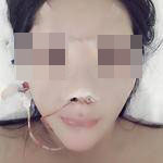 做了鼻子后換個發(fā)型再畫個妝美的不要不要的