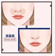 對鼻基底進(jìn)行填充的作用 是為了讓你與別人的與眾不同