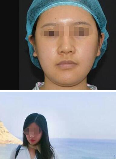 一周醫(yī)美行業(yè)資訊集錦【2020.05.18】