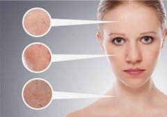 南昌除皺醫(yī)院匯總 激光除皺有哪些優(yōu)勢