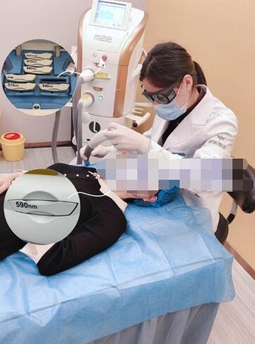 全新M22超光子嫩膚系列