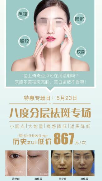 無錫施爾美整形5月23日祛斑美膚專場(chǎng)