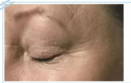 網(wǎng)紅抗衰項目熱瑪吉