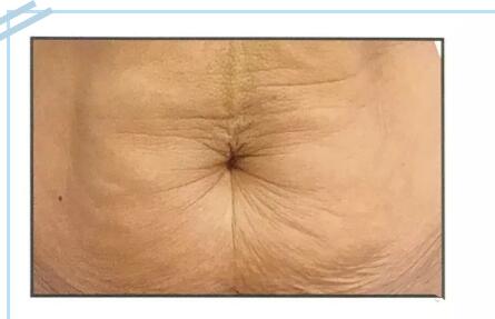 網(wǎng)紅抗衰項目熱瑪吉