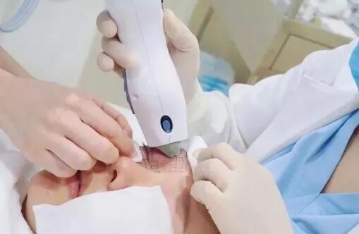 網(wǎng)紅抗衰項目熱瑪吉