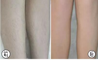 夏季是“醫(yī)美黃金期”這些適合做的醫(yī)美項(xiàng)目