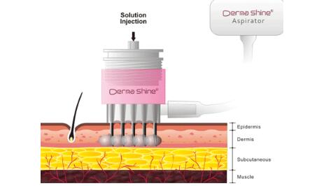 夏季是“醫(yī)美黃金期”這些適合做的醫(yī)美項(xiàng)目