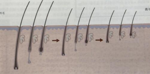 做為女生，為什么我的體毛這么粗濃？冰點(diǎn)脫毛無顧慮