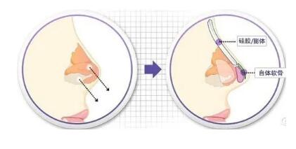 鼻子的美可是至關重要