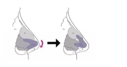 鼻子的美可是至關重要