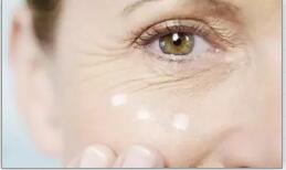 魚尾紋的四個等級