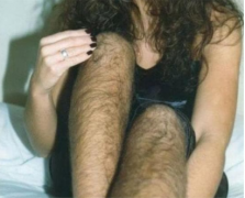 鄭州東方整形醫(yī)院脫毛的優(yōu)點 激光脫腿毛影響排汗嗎