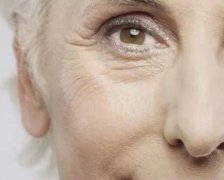 眼皮松弛怎么辦？如何避免眼皮松弛的情況？