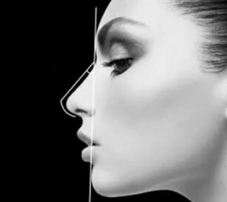 隆鼻和鼻部手術(shù)有什么不同？選擇哪一種手術(shù)方式更好？