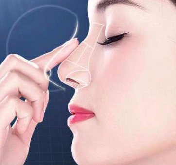 隆鼻不想做肋軟骨還能選什么方案？看上海九院劉凱怎么說(shuō)