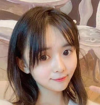 成都奕后孟祥宏醫(yī)生做隆鼻修復(fù)咋樣?僅三個(gè)月就宛若天生