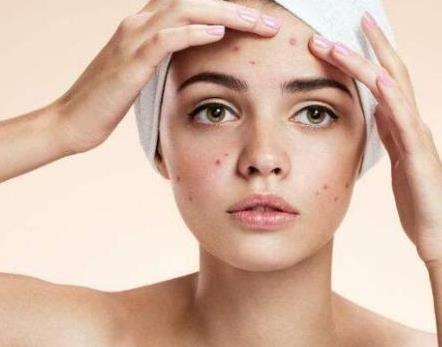 祛痘紅藍(lán)光祛痘果怎么樣？調(diào)節(jié)后會復(fù)發(fā)嗎？