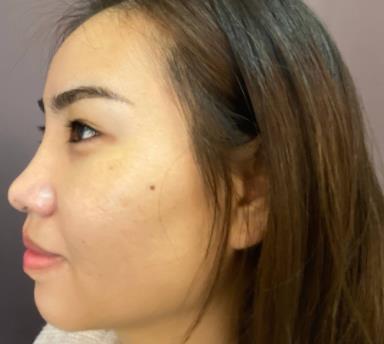 北京楊明勇技術(shù)好嗎？真人親身經(jīng)歷記錄&果展示