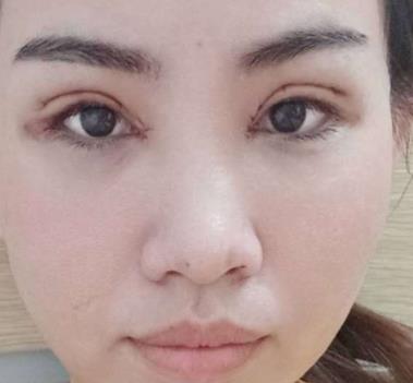 北京楊明勇技術(shù)好嗎？真人親身經(jīng)歷記錄&果展示