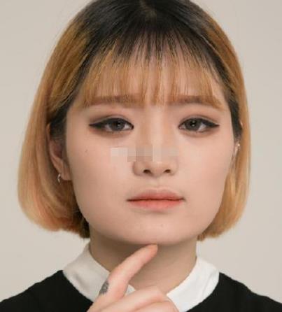 上海九院韋敏磨骨怎么樣?術(shù)后日記經(jīng)驗(yàn)分享