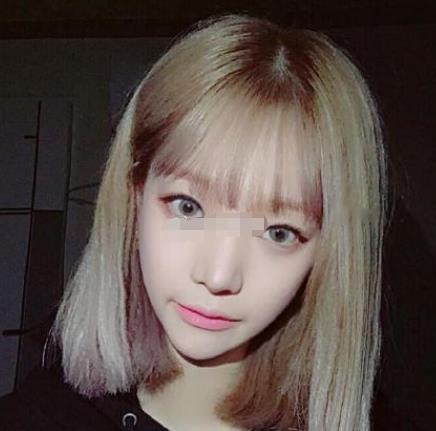 上海九院韋敏磨骨怎么樣?術(shù)后日記經(jīng)驗(yàn)分享