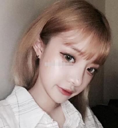 上海九院韋敏磨骨怎么樣?術(shù)后日記經(jīng)驗(yàn)分享